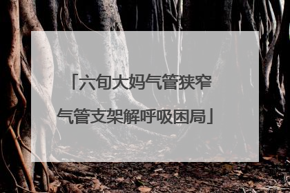 六旬大妈气管狭窄 气管支架解呼吸困局